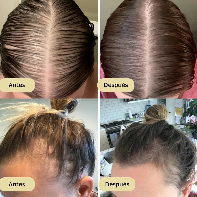 Aceite Natural™ ¡Transforma tu cabello en tiempo récord!